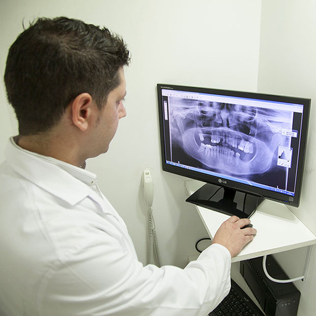 What Are All Those X-Rays For? – Circle Pines MN | Circle Pines Dental